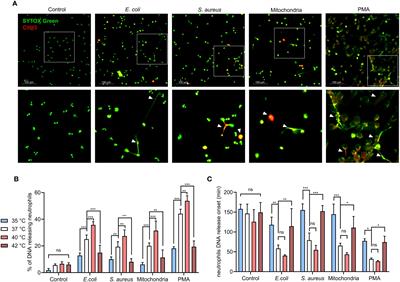 Neutrophil extracellular traps formation and clearance is enhanced in fever and attenuated in hypothermia